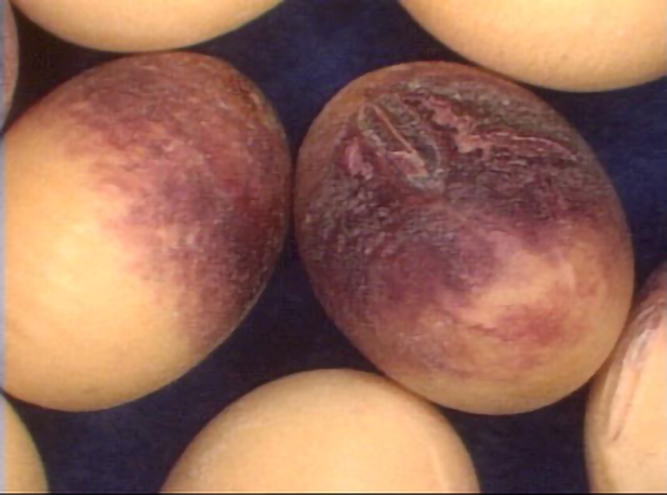 sintomi di malattia sui baccelli